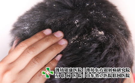摄图网_330166077_头发上涂着脱衣男装的男子皮肤科真菌头皮医疗药品薄片皮肤洗发水卫生分泌（企业商用）