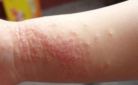 潍坊皮肤病医院排名