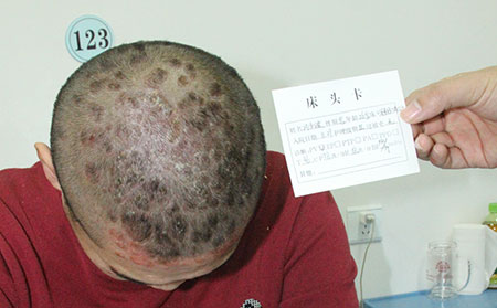 距离汽车站近的皮肤病医院